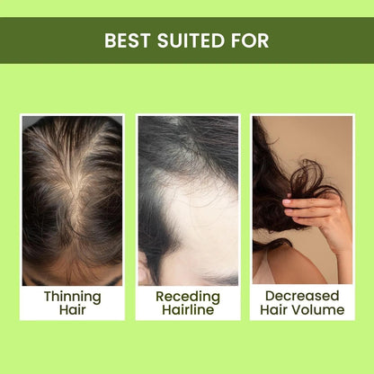 Rosemary Water, Hair Spray For Regrowth